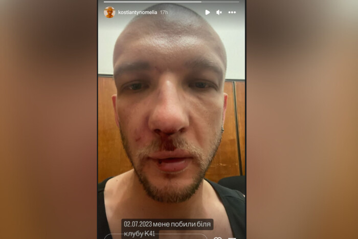 Суд покарав військового, який побив українського дизайнера через гомофобію