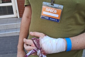 Син Чепурного Арсен під час вибуху ракети був у самому театрі, висвітлюючи захід, який там відбувався