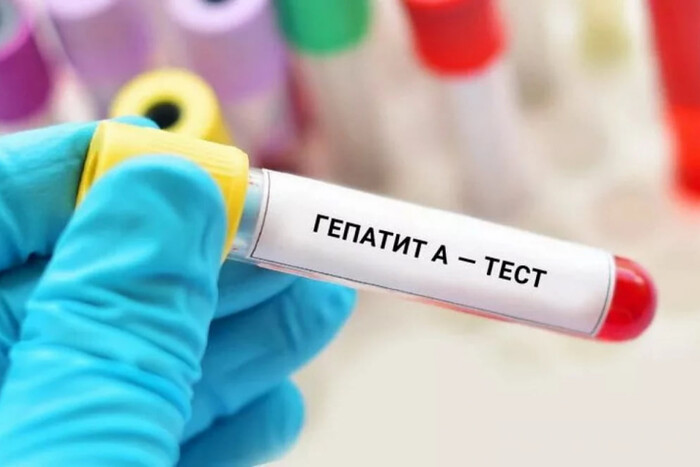 Новий пакет допомоги від США та гепатит A на Тернопільщині. Головне за 3 листопада