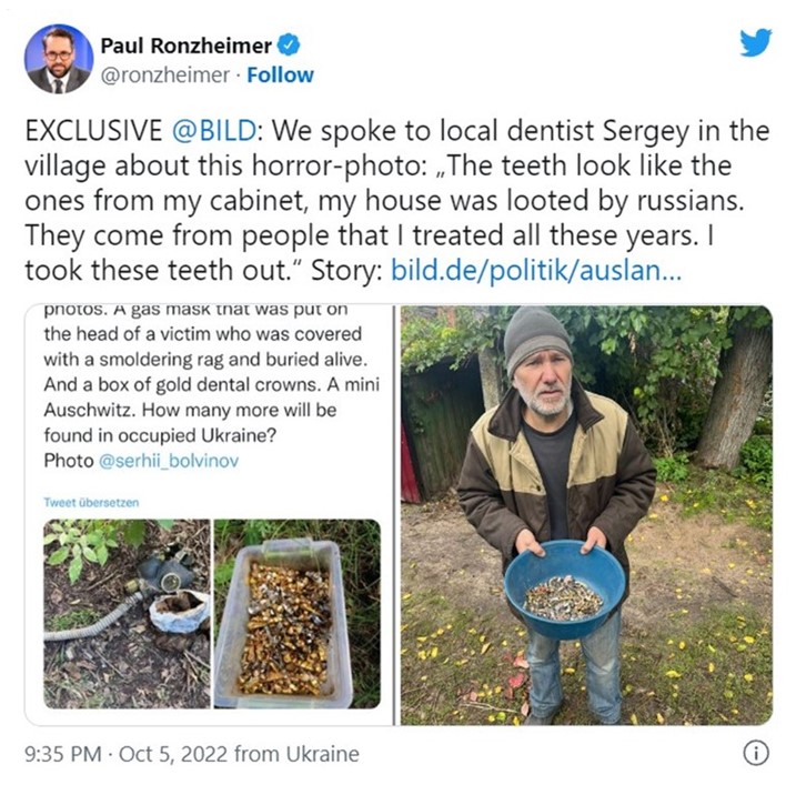 Журналісти Bild написали, що контейнер із зубами належить місцевому стоматологу Сергію