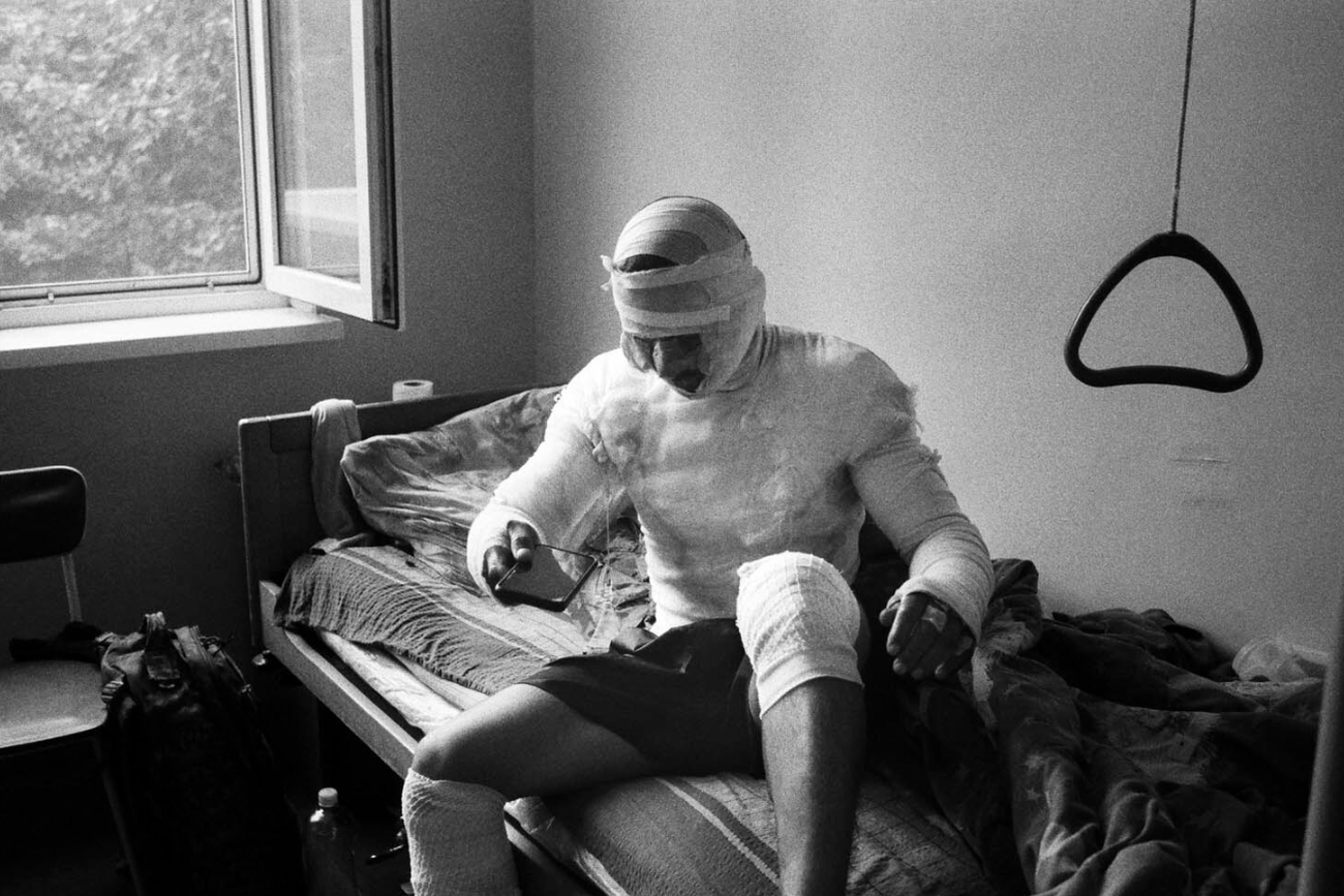 Поранений український військовий у госпіталі