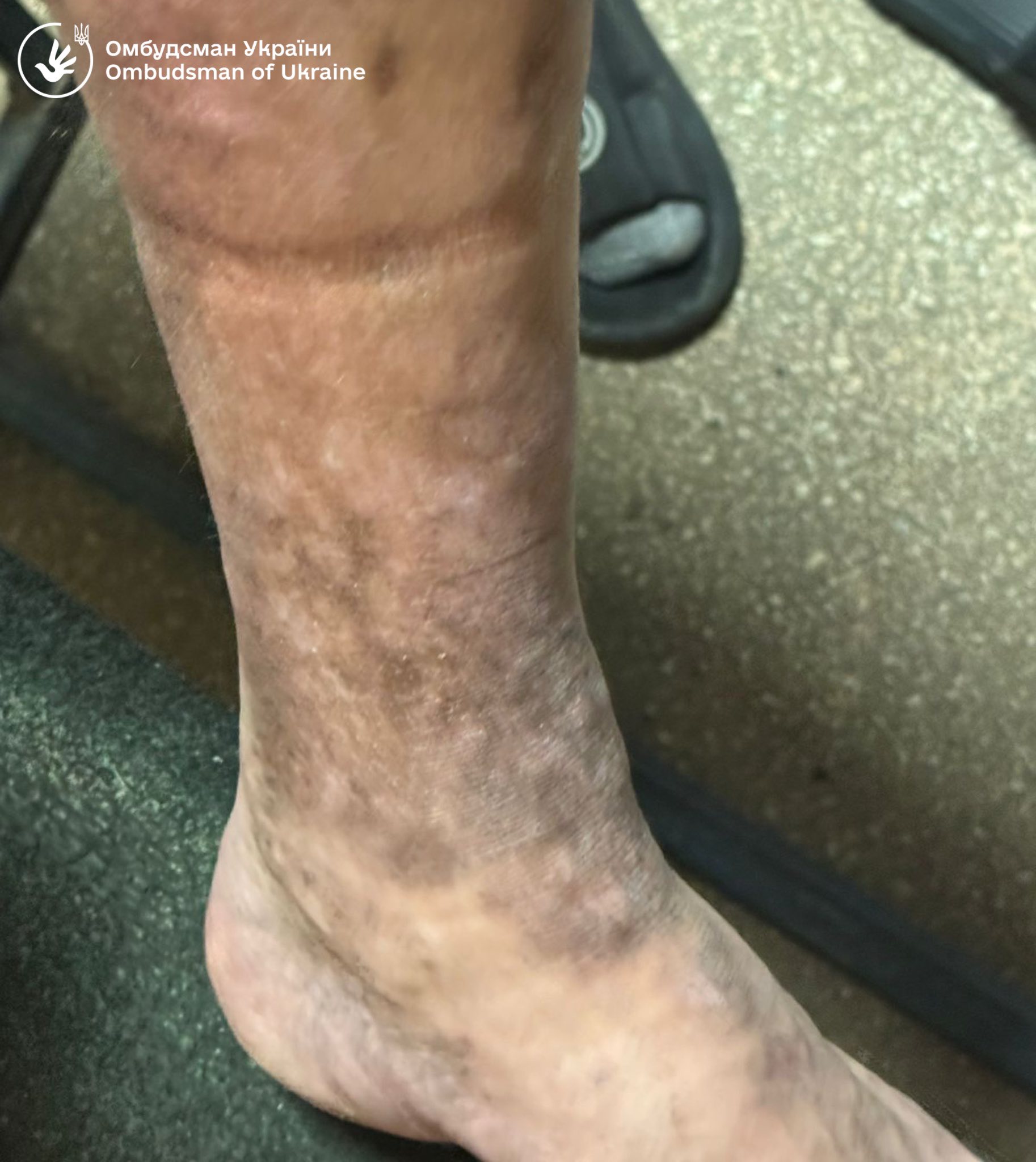 Один туалет на 60 людей: Лубінець показав жахливі умови в Ужгородському ТЦК фото 3