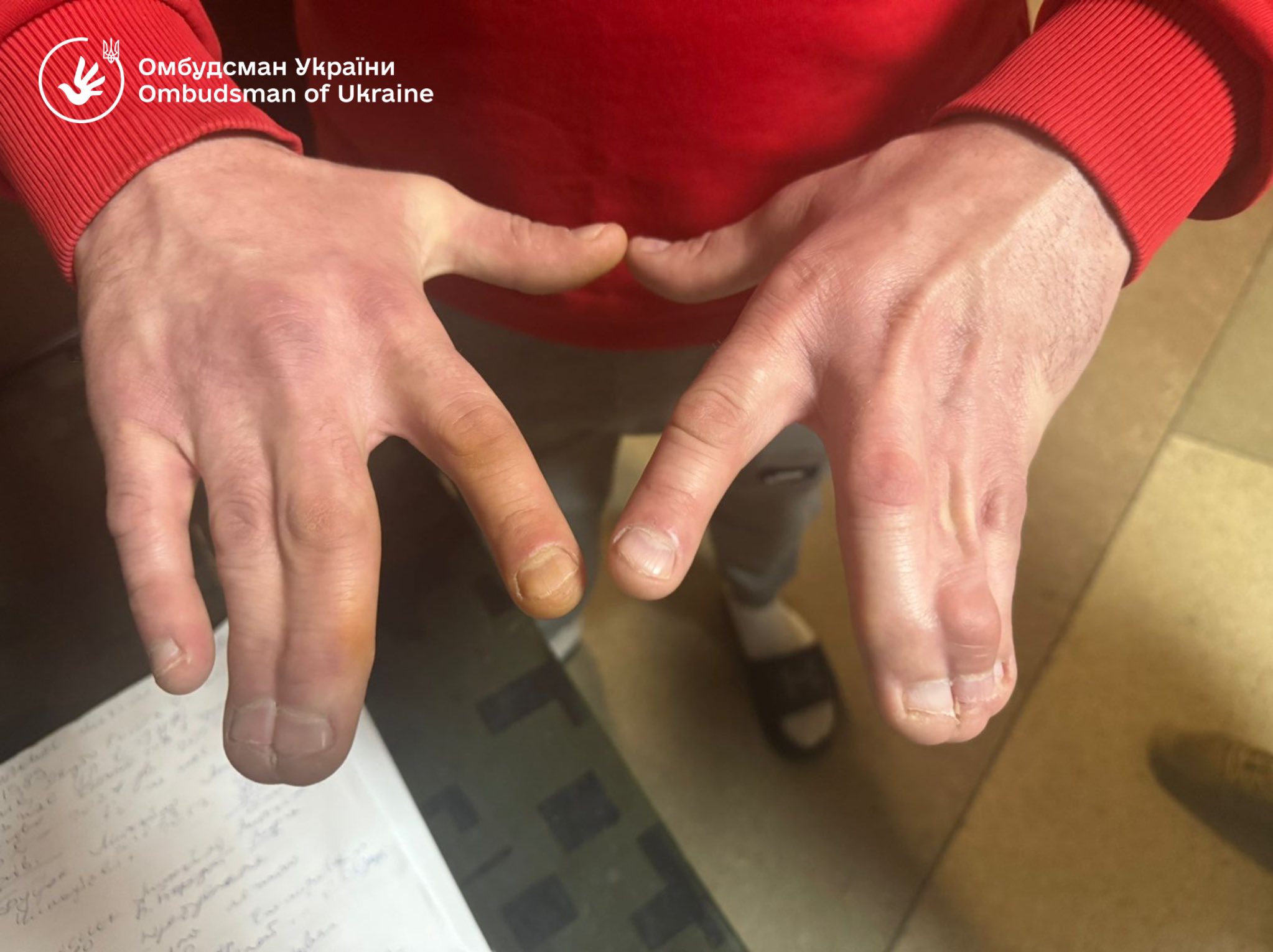 Один туалет на 60 людей: Лубінець показав жахливі умови в Ужгородському ТЦК фото 2