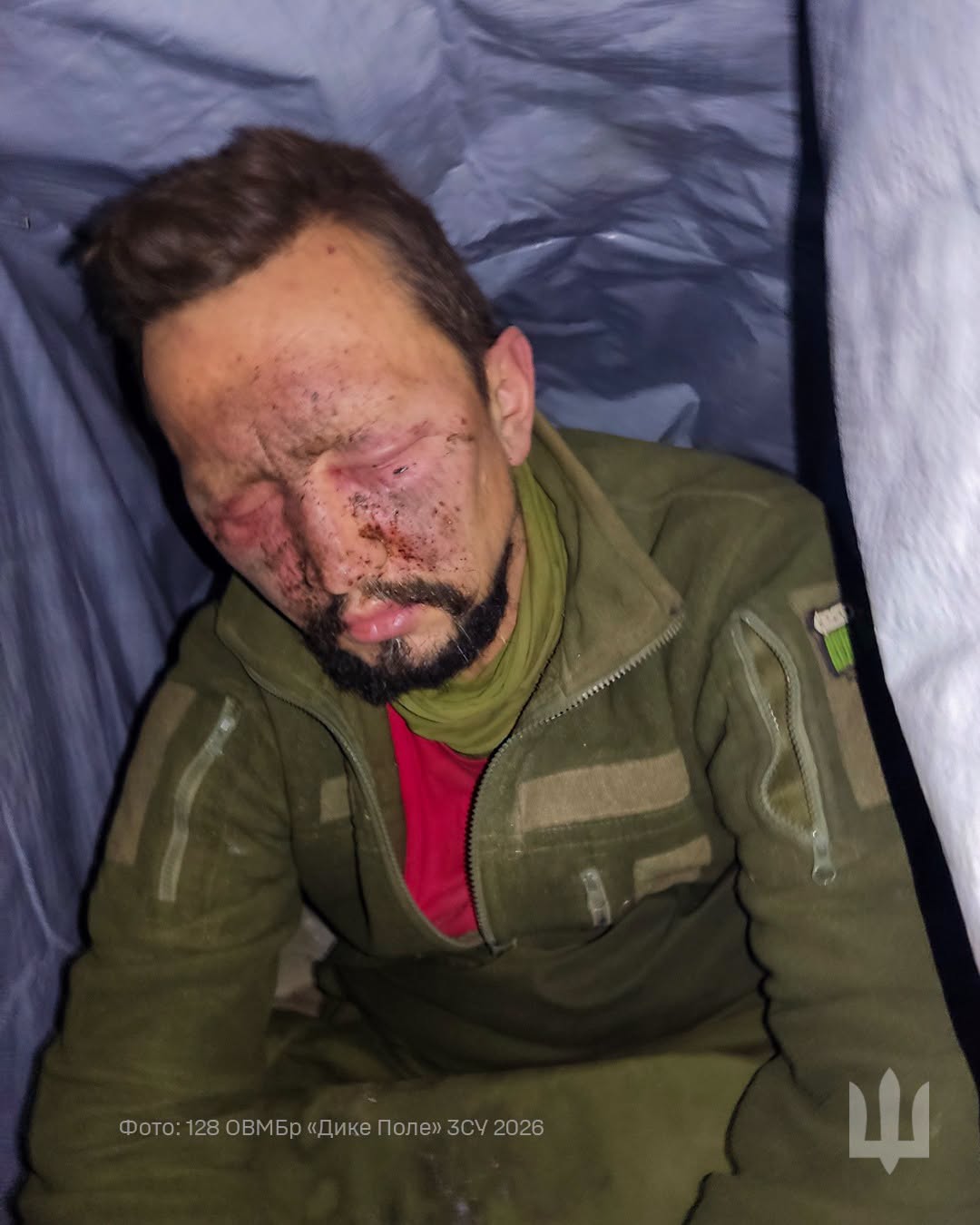 Військовий після важкого удару повністю втратив зір, але ще пів року залишався на позиціях  фото 1