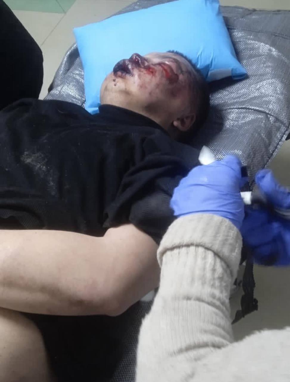 Військових «Вовків Да Вінчі» підозрюють у побитті і викраденні чоловіка: батальйон зробив заяву фото 5