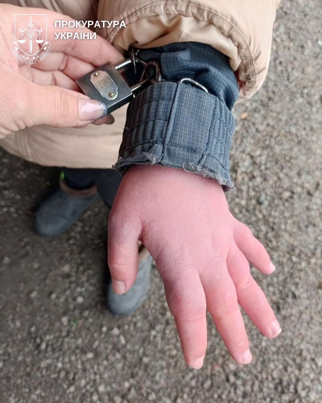 За словами прокурорів, унаслідок дій підозрюваної дитина отримала фізичні і моральні страждання