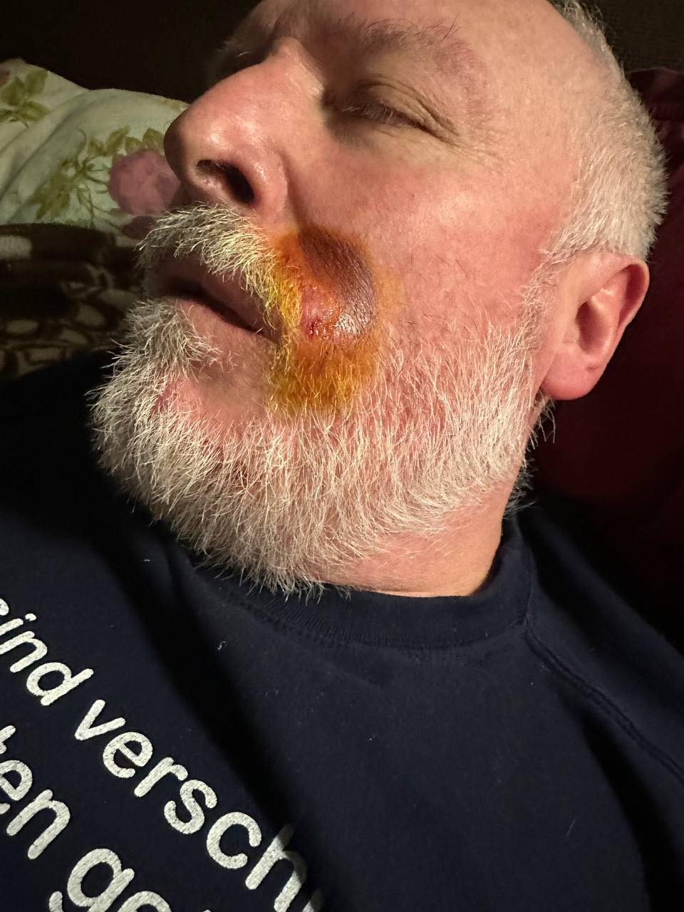 Кур’єр Glovo у Києві розбив обличчя 65-річному чоловікові