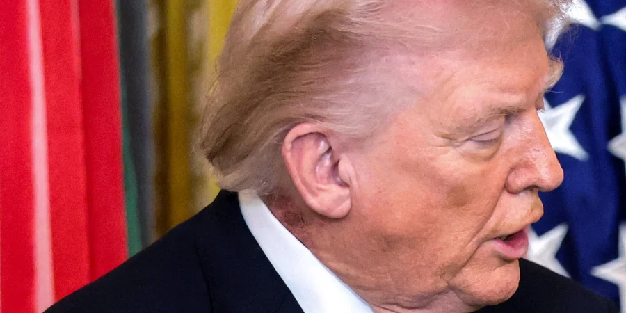 На що хворіє Трамп? Фізіотерапевт висунув нові припущення фото 5