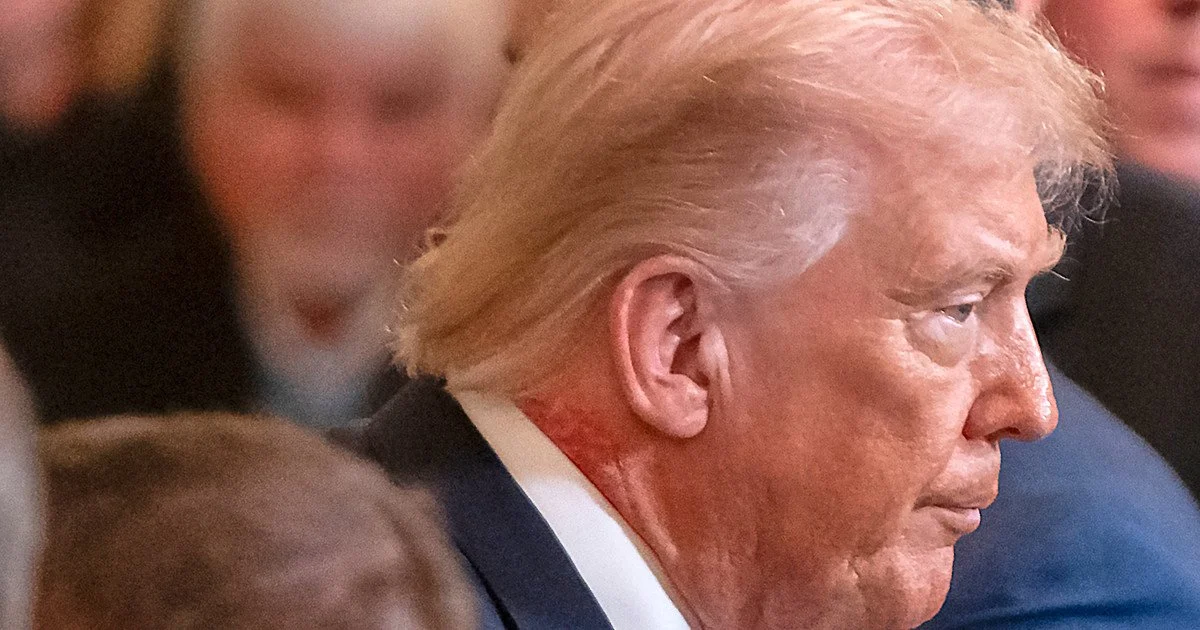На що хворіє Трамп? Фізіотерапевт висунув нові припущення фото 4