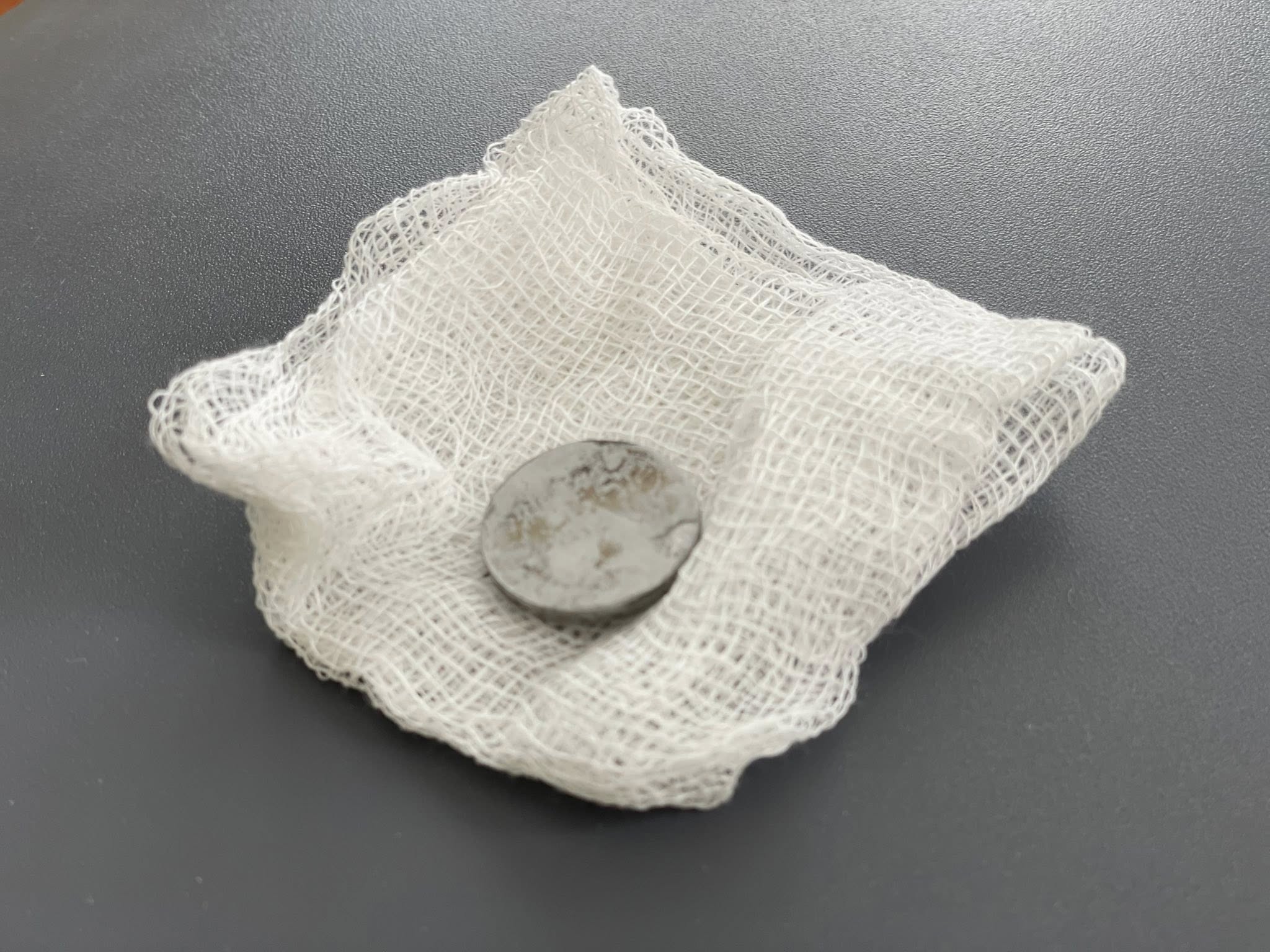 У стравоході дівчинки була літієва батарейка діаметром 2,5 см