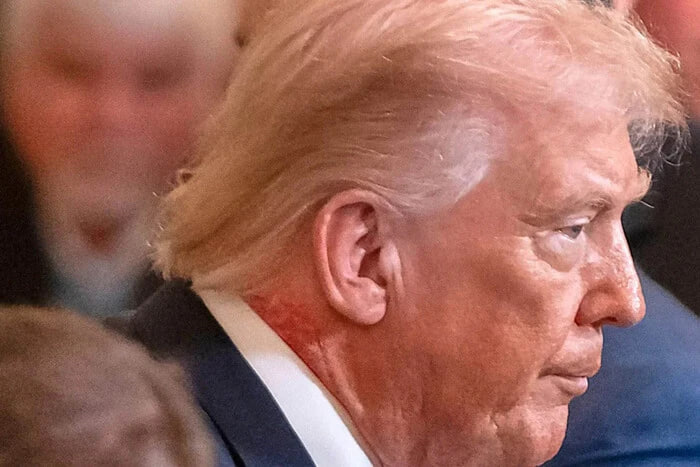 На шиї Дональда Трампа помітили червону пляму