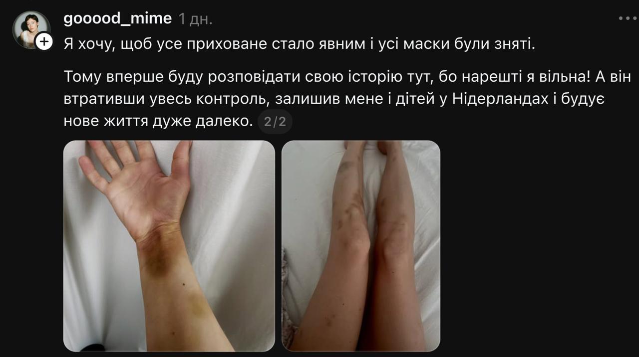 Дружина українського ведучого заявила про домашнє насилля (фото) фото 2