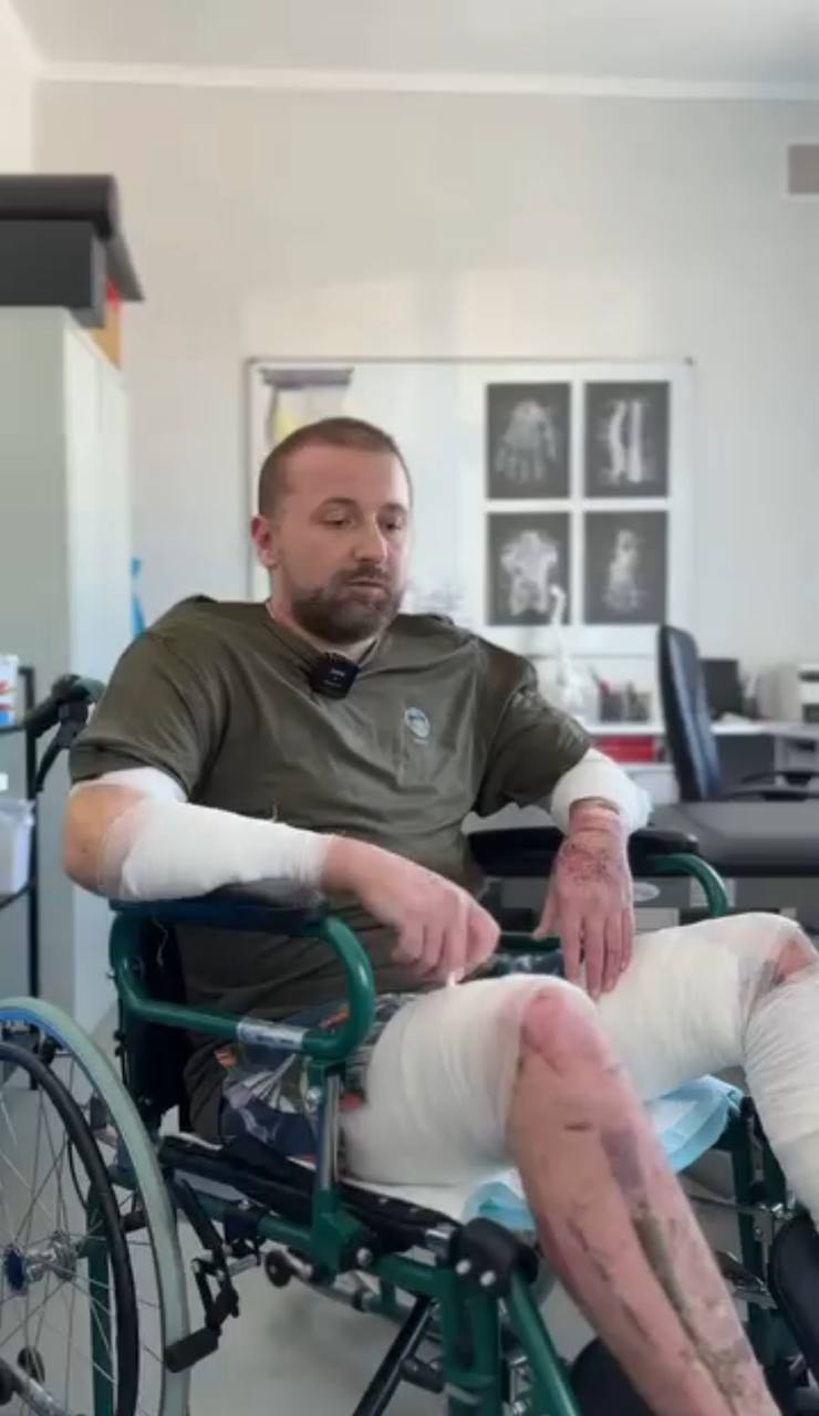 Олег Тиндик постраждав внаслідок вибуху бойлера