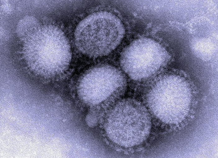 Такий вигляд має вірус грипу підтипу А. Ним людина може заразитися не лише від людини, а й від ссавців та пташок (фото з відкритих джерел)