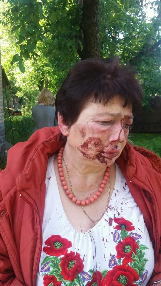 Людмила Демченко після нападу (Фото: Ольга Червакова, Facebook)