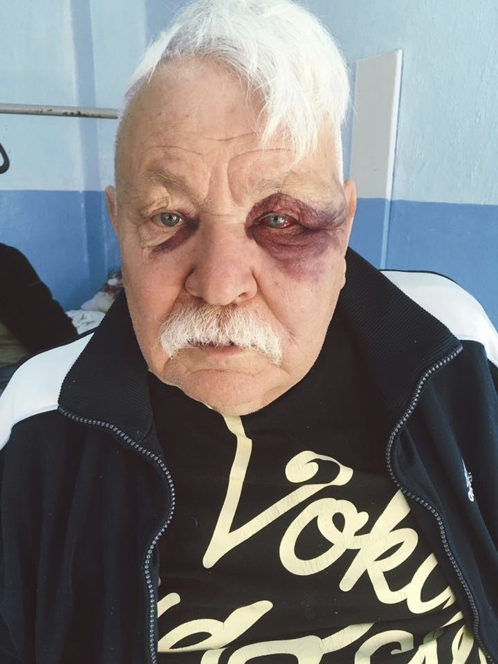 Володимир Смагітель після побиття на лікарняному ліжку (Фото зі сторінки Володимира Смагітеля Фейсбук)