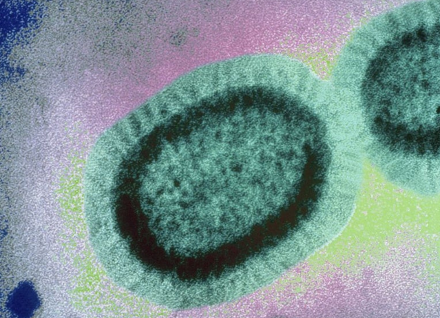 Такий вигляд під мікроскопом має вірус грипу підтипу В. Ним людина може заразитися тільки від людини (фото popsci.com)