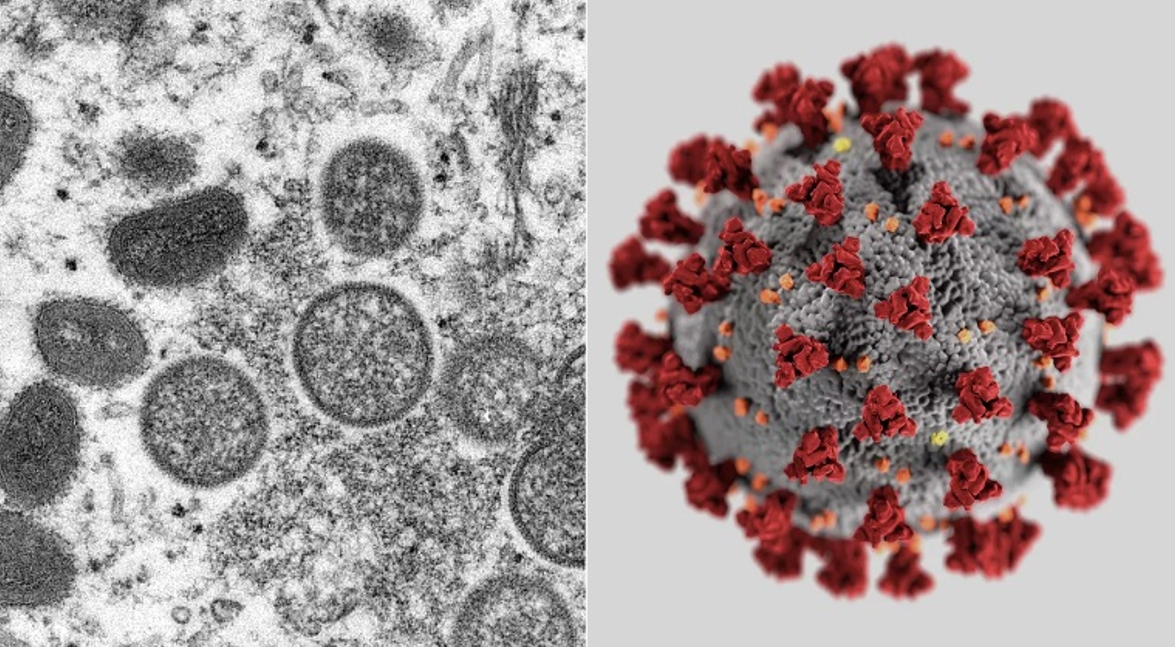Зліва – віруси мавпячої віспи, справа – коронавірус Sars-Cov-2