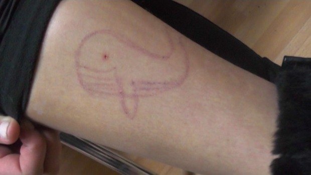 Подростки вырезают «синего кита» на руке
