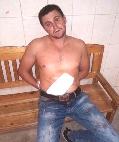 Олександр Ісайкул після інциденту. Фото з відкритих джерел