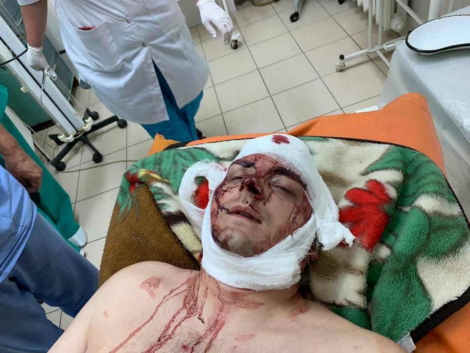 Постраждалий внаслідок нападу екс-мер Конотопа. Фото: Facebook Олени Сердюк