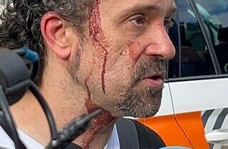Кривавий терор в Італії: у центрі Модени чоловік на авто чавив перехожих та нападав з ножем