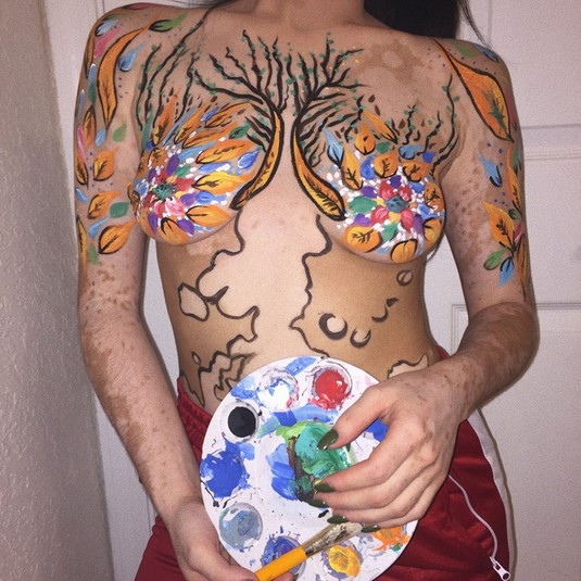 Карта мира на теле: девушка превратила свою болезнь в произведение искусства